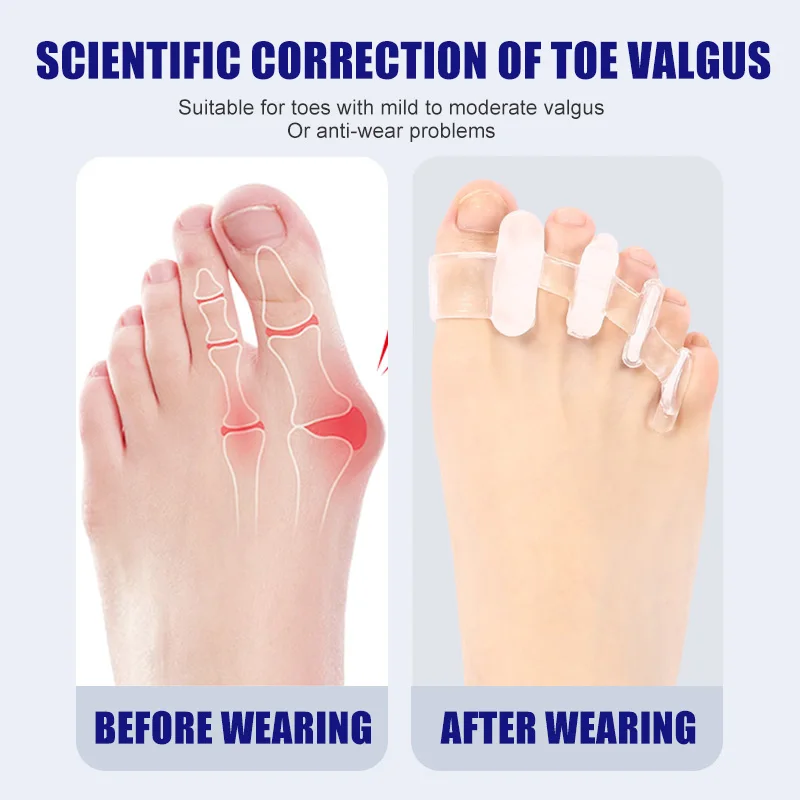 1 пара силиконовых сепараторов – обзор и цена Yoga Toe Separator