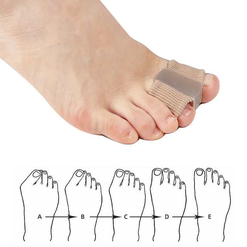 Набор из 4 силиконовых раздели – обзор и цена Yoga Toe Separator